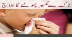 nose bleeding nakseer ka ilaj islamic treatment /prayer/ wazeefa